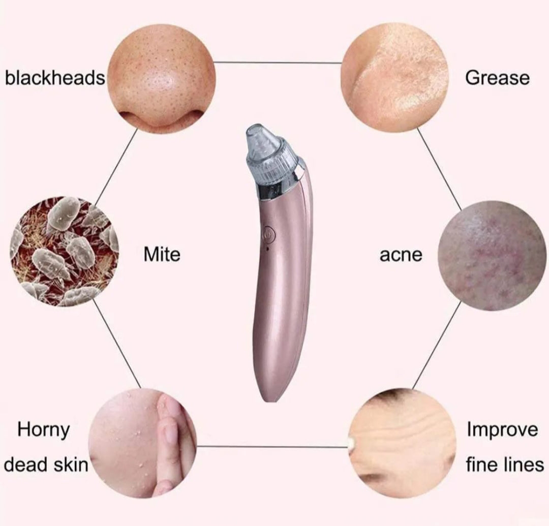 Máq Eléctrica p eliminar puntos negras